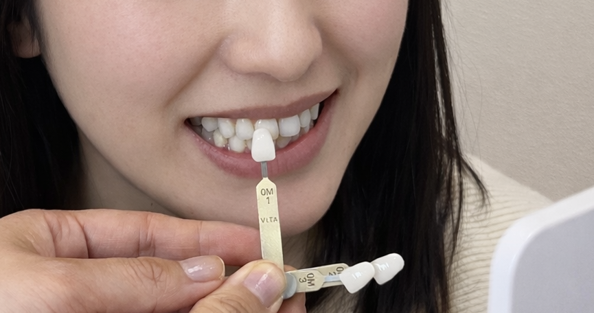 色・形を自然に合わせられる